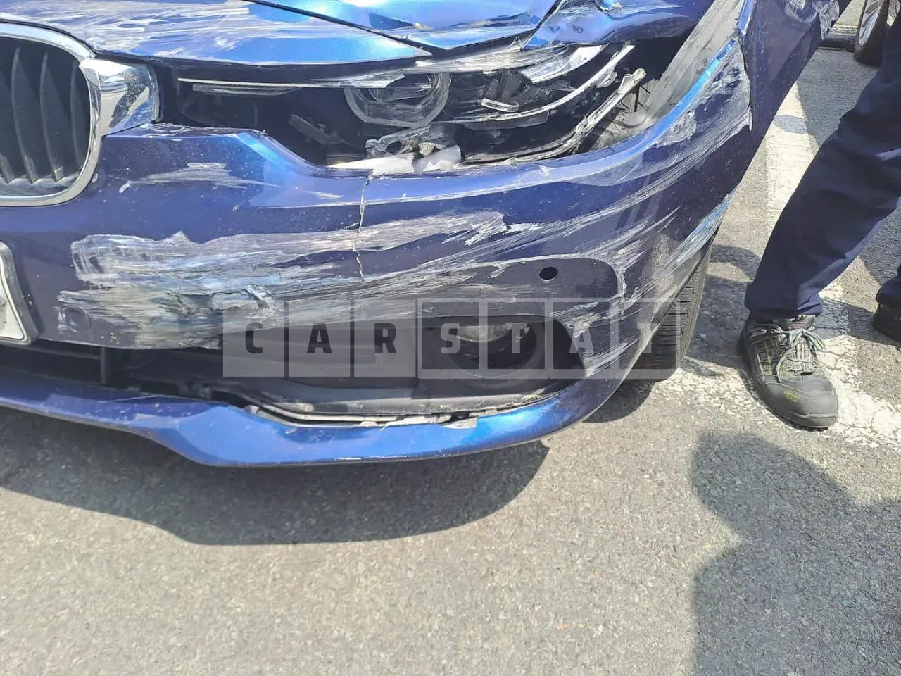 Photo 2 of 20: 2016 BMW 320d, VIN WBA8C5101GK640736 — Korean insurance auction
