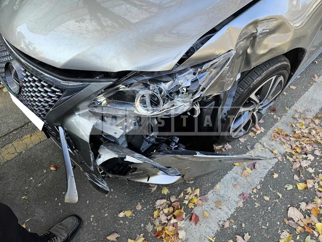 Photo 2 of 32: 2018 Lexus CT200h, VIN JTHKD5BH1J2328027 — Korean insurance auction
