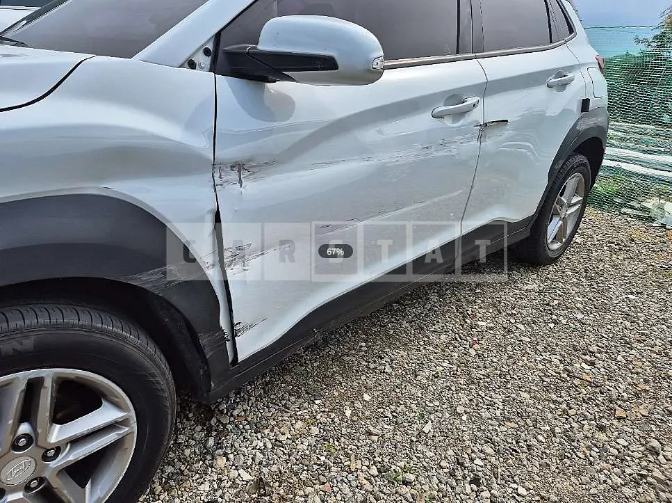 Photo 2 of 8: 2017 Hyundai Kona Diesel — Korean insurance auction