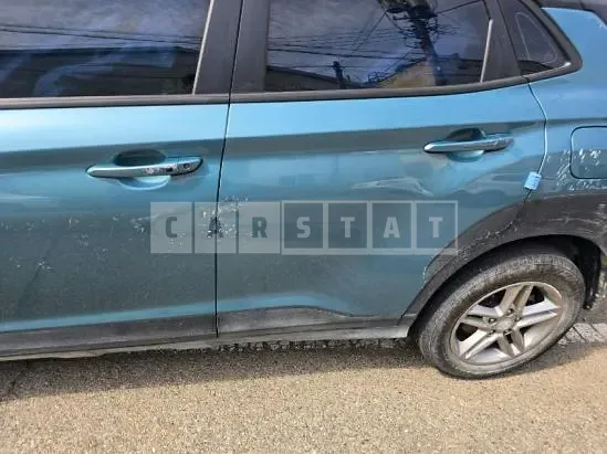 Photo 2 of 13: 2018 Hyundai Kona — Korean insurance auction
